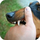 Dog Bite
